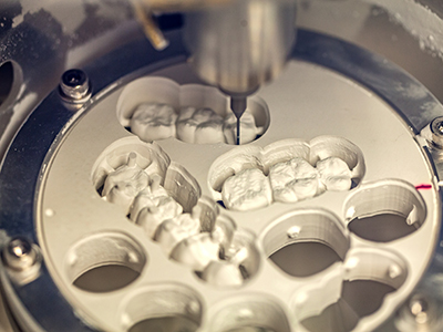 South Miami Family Dental | Dentures, Inlays  amp  Onlays and Laser Dentistry